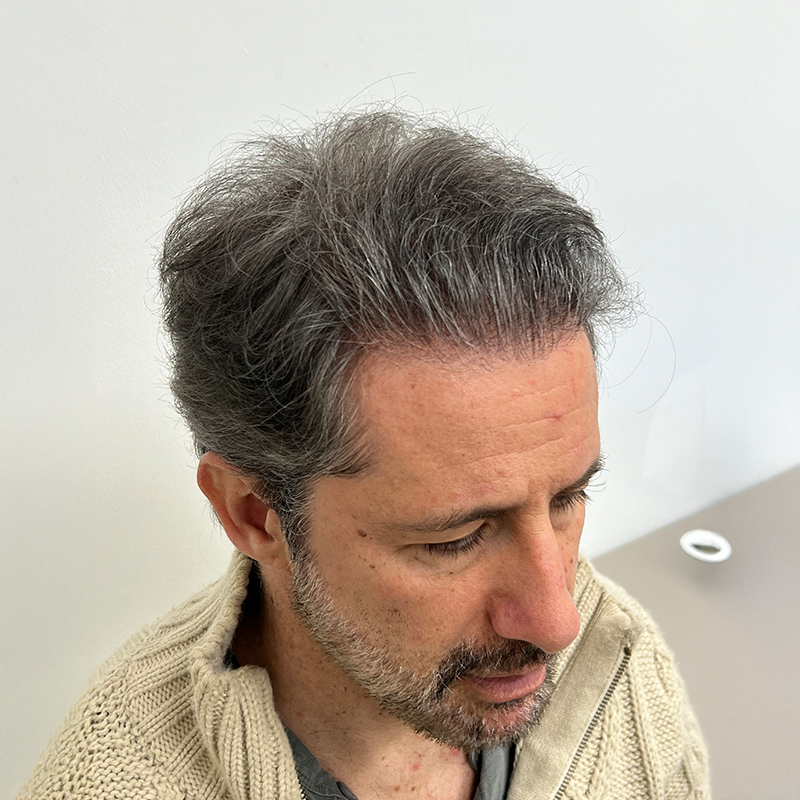 Antes
