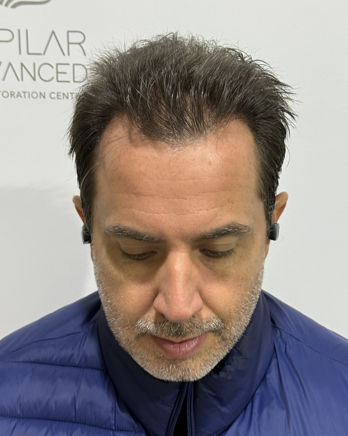 Despues Luciano Tartarini