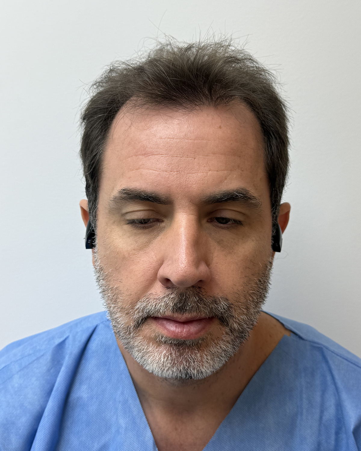 Antes Luciano Tartarini