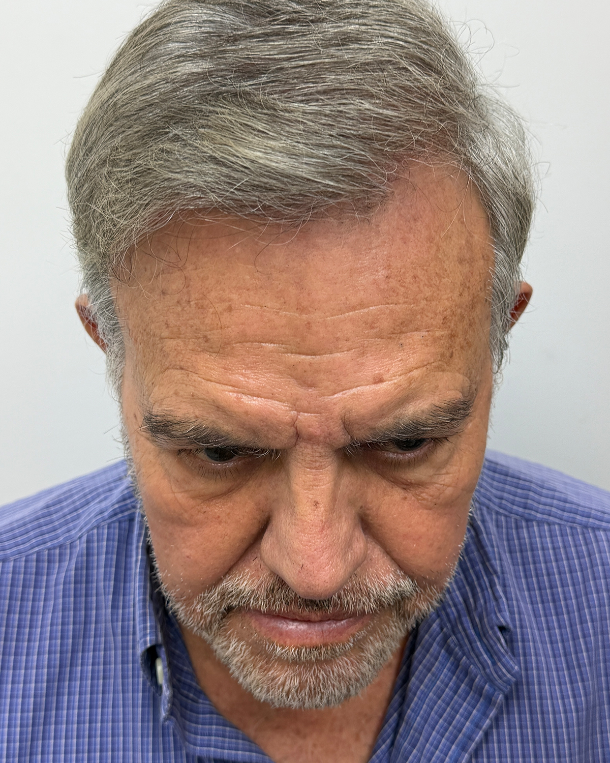 Despues Luis Alcazar